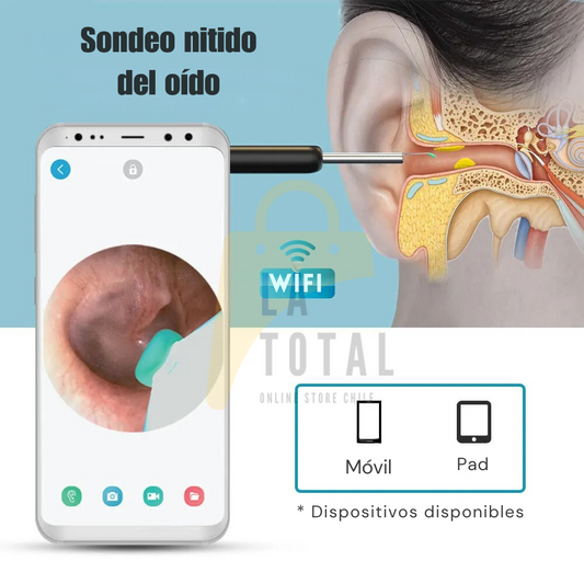 ClearWax Pro™ Endoscopio inteligente inalámbrico